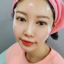 기미 잡티 레이저 사직동 리네이처에서 진짜 효과 많이 봤어요
