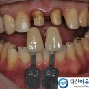 다산치과기공소 이미지