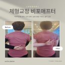 스마일체형교정센터 이미지