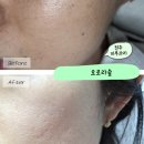 태그아웃 | 전주속눈썹 오로라숲 태그아웃케어로 피부관리