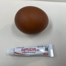 구순포진 치료기간 및 하이로버 크림 실제 사용 후기