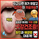 화정베스트이비인후과의원 | 자고 나면 혀가 하얗고 입천장이 까끌까끌, 입속 건조함 해결법은? 광주베스트이비인후과