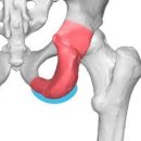 좌골 점액낭염 및 (양반다리 엉덩이 통증) 이미지