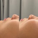 씨유 미아미아점 | 강북구피부관리 예시연뷰티랩에서 헤드스파 팔자관리 받고 온 찐 후기