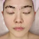 더드림메디칼 | 송도 모공 관리 올가드림뷰티 송도점 자극 없어 좋았던 후기