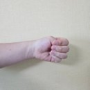 여주바른정형외과의원 | 임신과 출산으로 인한 손목 건초염 치료 후기 _ 여주 바른정형외과🦴