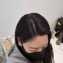 스칼프디자인센터 마곡 SMP 헤어라인 찐후기