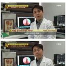 비염이 치매에 미치는 영향 이미지
