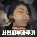 부산 서면 피부과 인모드 포마 시술 붉어짐 &amp; 통증 솔직 후기