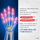 손가락 통증을 유발하는 질환 5가지 이미지