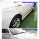 덴트렉스 이미지