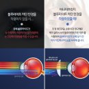 오세민안과의원 네이버블로그