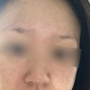 디자인필&시선 | [피부를디자인하다] 발산역 피부관리 맞춤 케어로 좁쌀과 모공 고민 해결하고 온 후기