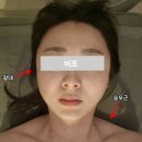 송파구 잠실 피부 관리 핫탄스타 잠실점 얼굴 윤곽 마사지 관리 후기