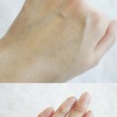 바른메디케어 이미지