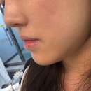 수분옆들 | 울산 피부관리 올가드림뷰티 복산점 수분 폭탄 관리 후기