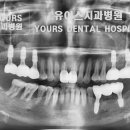 유어스치과병원 네이버블로그