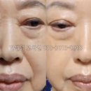 인셀덤 초이