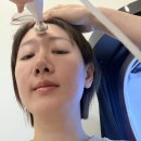 강남 | 기미잡티제거 레이저토닝가격 10회차 강남피부과 후기