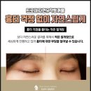 트로이성형외과 이미지
