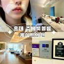 케이트의원 | 홍대 쥬베룩볼륨 후기, 케이트의원 쥬베룩볼륨 봄맞이 시술 추천