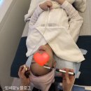 <스킨케어>레이저토닝