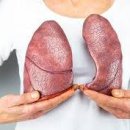 건강기체조 이미지