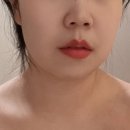 본피부 에스테틱 분당야탑점