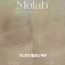 아르나뷰티(Arna beauty) | 루원시티 색소침착 멜라닌케어🎀