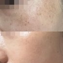 삼산약국 | 도미나크림 가격 약국별 가격 효과 찐사용법 총정리 (내돈내산)