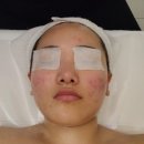 합정피부관리 &lt;유디톡스&gt; 수기 페이스관리 후기