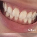 르블랑치과의원 이미지