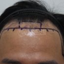 모먼트의원 이미지