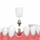 금세치과의원 이미지