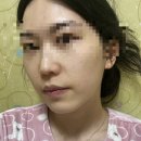 세안@ | 허브비누 세안 후기, 세안비누추천·세수비누추천 | 히말라야