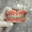디엠(DM) 치과기공소 | 의정부 덴쳐기공소 덴쳐전문기공소 디엠치과기공소 신규오픈했어요‼️