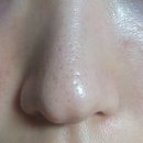 열린 씨앤피 | /올리브영 코팩/ 차앤박(씨앤피) 안티-포어 블랙헤드 클리어 키트 후기