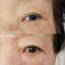 정다은뷰티랩 | 달서구 피부관리, 월성동의 정다은뷰티랩, 플라즈마 블라스트 리얼후기