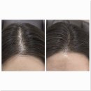 네일샵에스 아를솔즈 문제성발톱 발각질 네일