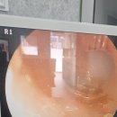 메디컬보청기 중랑점 이미지