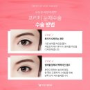 프리티성형외과의원 이미지