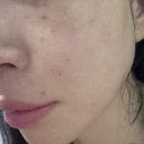 탈출템 찾았다… 피부 컨디션 살아나는 수분크림 [이손랩 데이즈 스피룰365 그린 수분 크림 재구매 후기]
