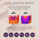 네오웰빙 | 네오알파고주파기 사용후기모음