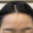 울산왁싱 라미뷰티랩 헤어라인왁싱 후기