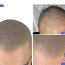 탈모왕 광주점 이미지