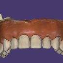 이종규치과의원 | 미니쉬 세미나 수료후기