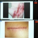 가세연 긴급 기자회견에서 故 김새론 녹취록 공개, 녹취록 제보자 미국에서 피습된 상황과 FBI 수사 중...