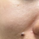 주식회사 보령 | [비알머드] 릴리프 머드 마스크, 팩투폼 클렌저 후기 : 올리브영 머드팩 및 유레카 이채연 머드팩