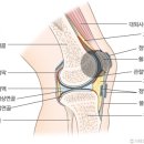 무릎통증의 위치와 부상원인 이미지