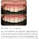 블랙필름